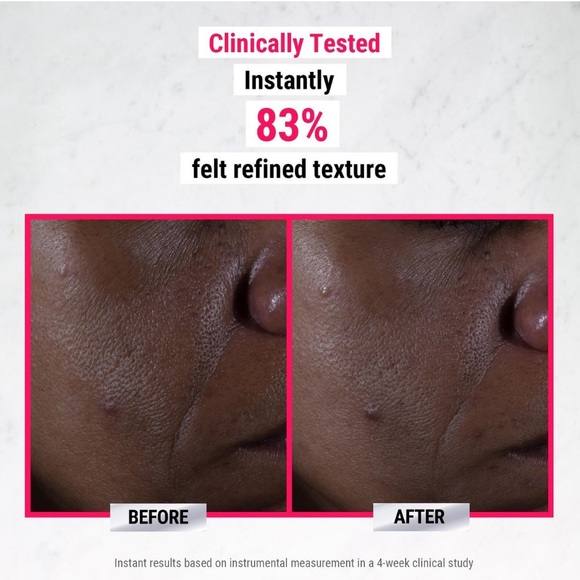 ONLY 1! Kiehl’s Ultra Pure High-Potency 9.8% Glycolic Acid Serum 💧 NEW IN BOX - Picture 4 of 7